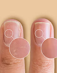 SolarOil Nail & Cuticle Care