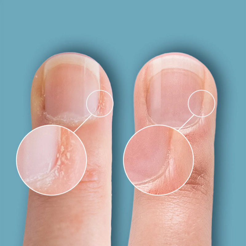 Cuticle Eraser Gentle Exfoliator