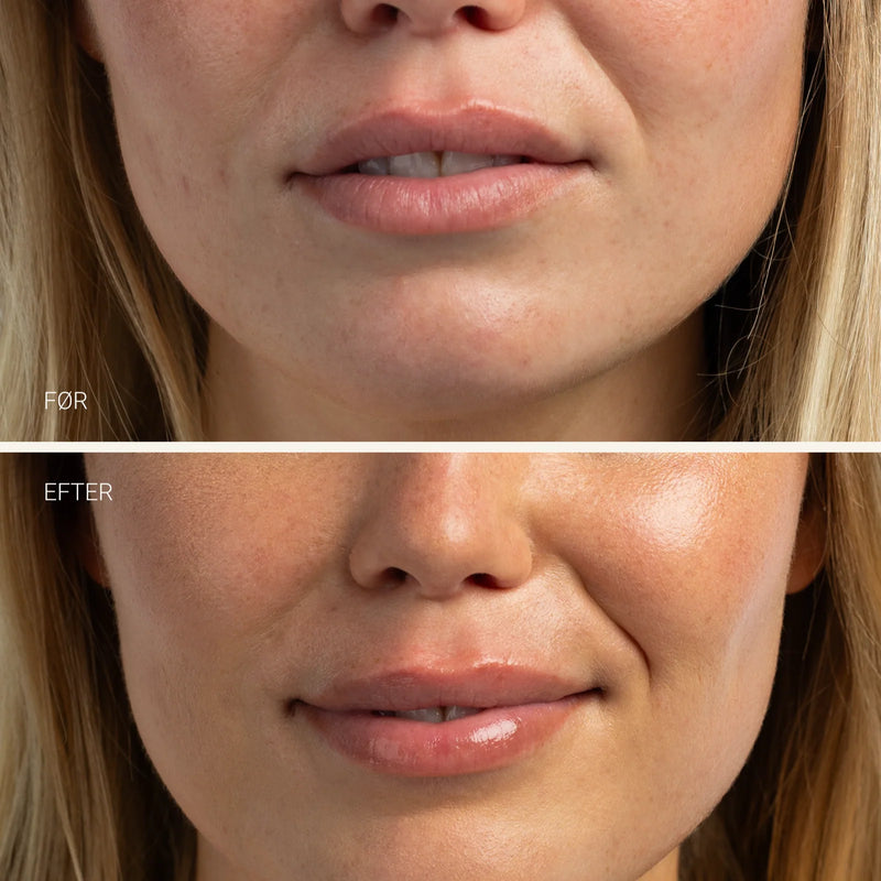 SANZI Lip Balm Hydrating